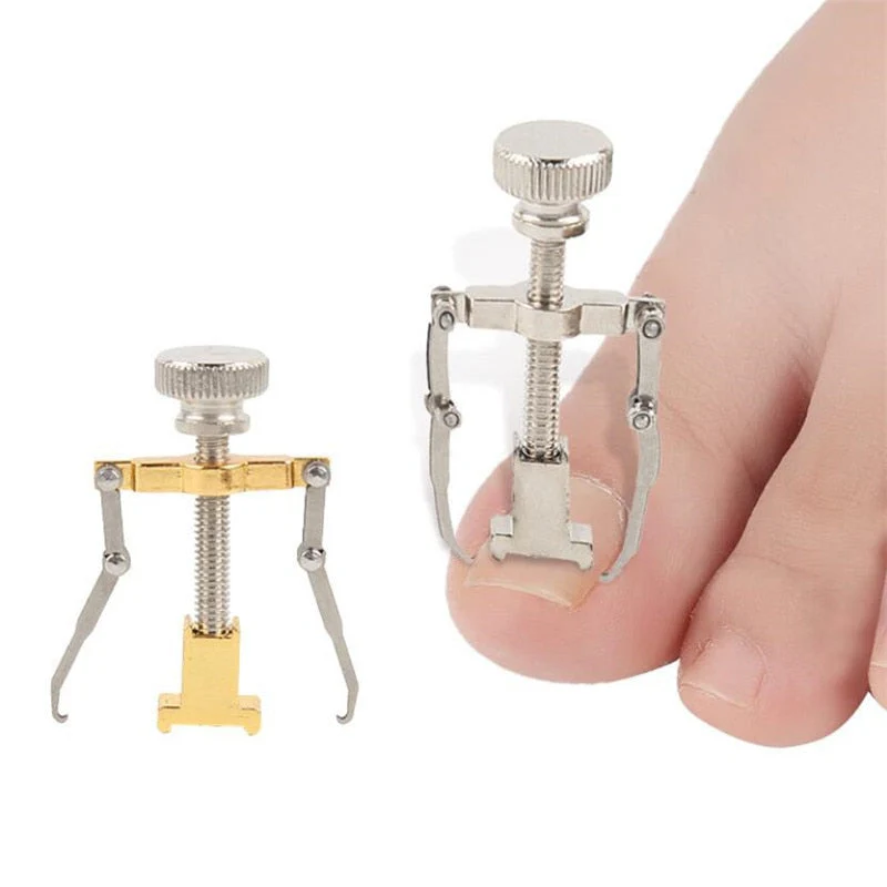 Correcteur d&rsquo;ongles incarnés